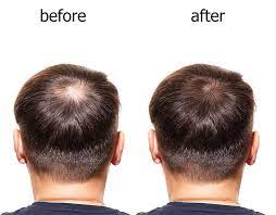 Hair Treatment Image